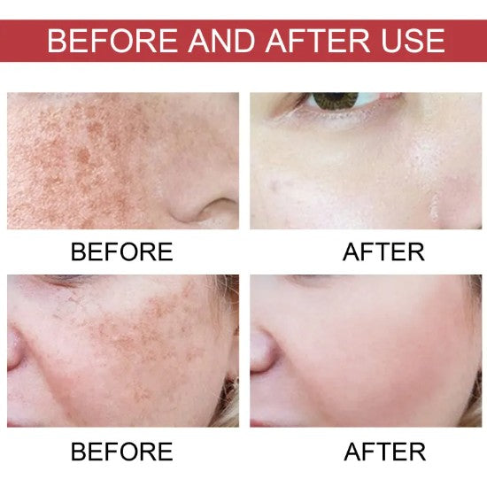 Fade Skin Spots Moisturizing Care Solution